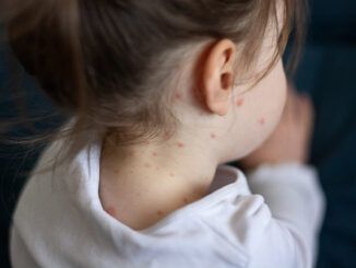 Los pediatras advierten del aumento de la incidencia y de brotes localizados de sarampión